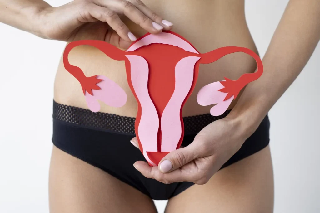 Maestría en Endometriosis 3