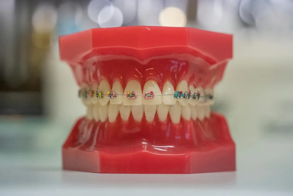 https://fr.iseie.com/wp-content/uploads/2025/04/Curso-en-Diseno-Digital-de-Protesis-Dentales-1.webp