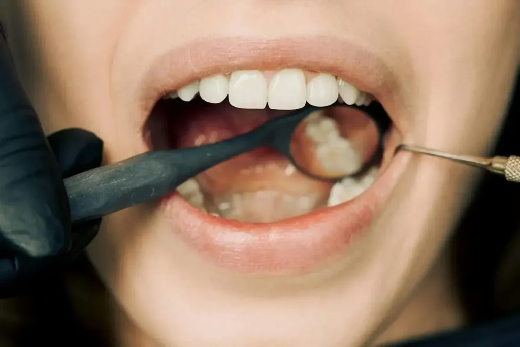 Diplomado-en-Tecnicas-Avanzadas-de-Blanqueamiento-Dental-1