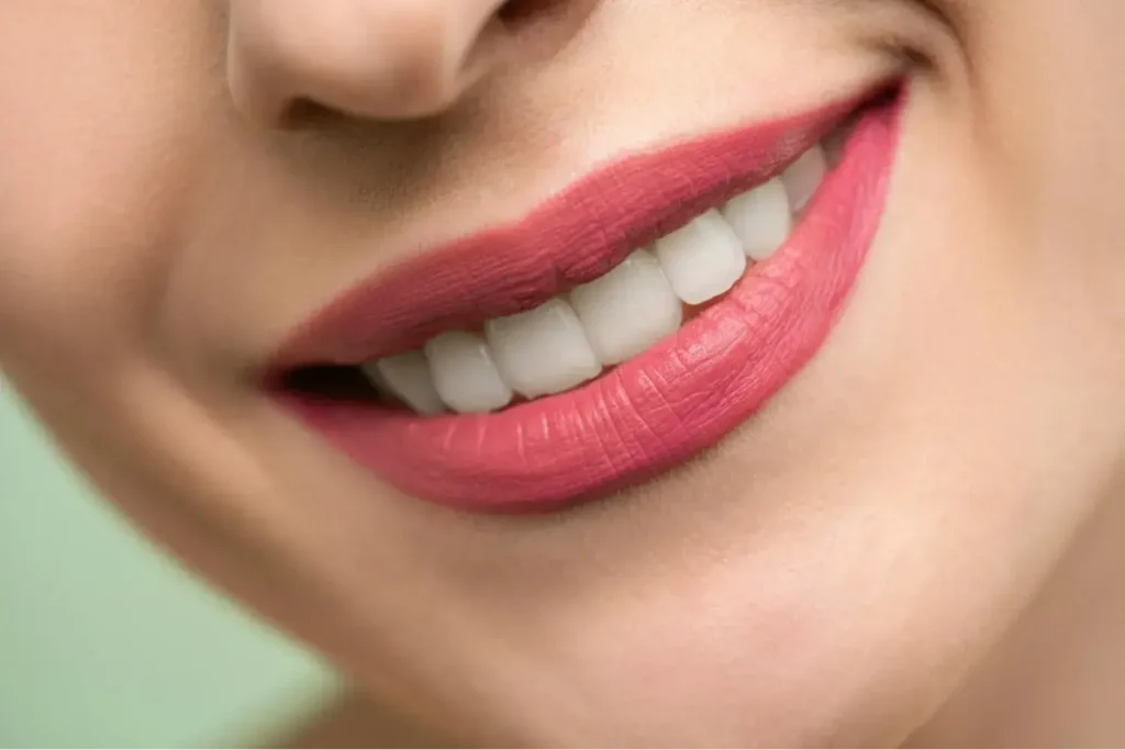 Diplomado-en-Tecnicas-Avanzadas-de-Blanqueamiento-Dental-3