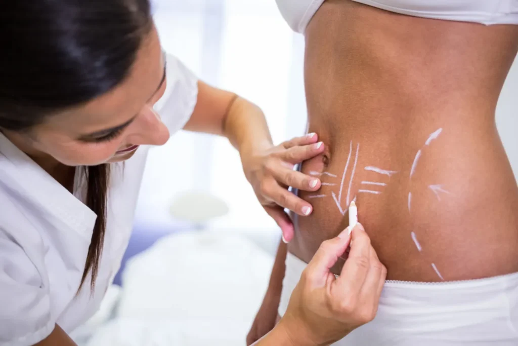 Maestría en Abdominoplastia y Cirugía Postbariátrica 3