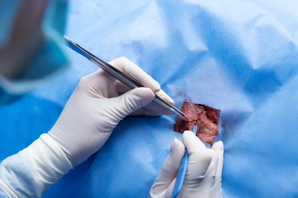 Maestria-en-Cirugia-Ginecologica-Minimamente-Invasiva-3