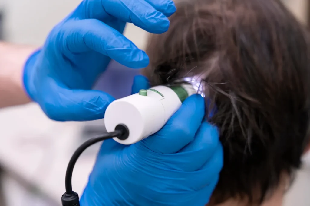 Maestría en Patología del Cabello y Cuero Cabelludo Dermato-Tricología 3