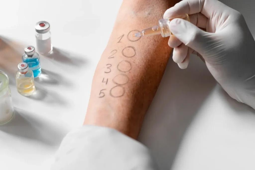 Maestría en Skin Barrier y Reparación Cutánea Microbioma y Barrera 3