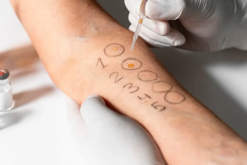 Master en Skin Barrier et Réparation Cutanée Microbiome et Barrière 1