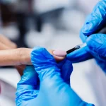 Master en Ongles, Pathologie Esthétique et Reconstruction 1